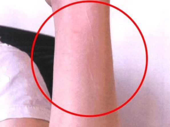 scars.png